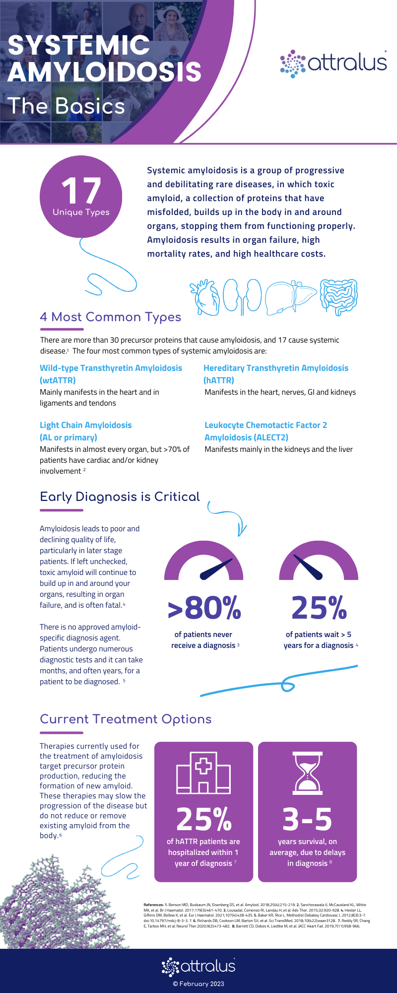 The Basics of Systemic Amyloidosis - Infographic